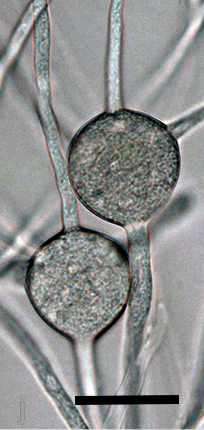  spherical hyphal swellings with radiating hyphae which appear like small chlamydospores except that the wall doesnrsquo;t form; scale bar = 25micro;m 
